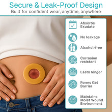Load image into Gallery viewer, Ostomy Adhesive Barrier Ring
