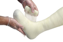 Load image into Gallery viewer, Cutimed Off-Loader Tcc System (Plaster &amp; Fiberglass)
